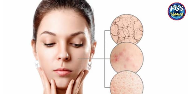 सर्दियों में रुखी और बेजान त्वचा के लिए घरेलू नुस्खे, skin care